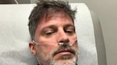 “Days of Our Lives” Star Greg Vaughan Hospitalized After Health Scare: 'My Lungs Were Full of Fluid'