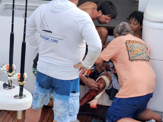 Man bitten after falling into shark-infested waters thanks South Florida surgeons who saved his leg