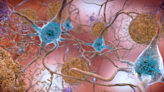 Una nueva estrategia para frenar la acumulación de proteínas vinculada a la ELA y el alzhéimer