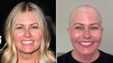 Nicole Eggert Shaves Her Head Following Breast Cancer Diagnosis