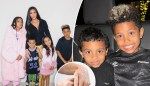What is vitiligo? All about the disease affecting Kim Kardashian’s son