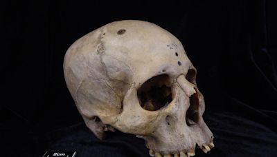 Ancient Egyptian skull shows oldest attempt at cancer surgery