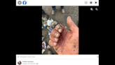 Husband spends hours digging in NC landfill after wife loses engagement ring in trash