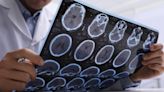 Hyperfine’s portable MRI shows promise in stroke detection