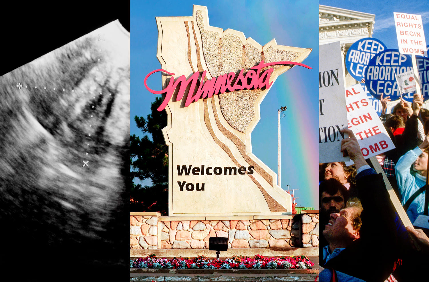 Opinion | I don’t live in Minnesota. But thanks to Tim Walz, my life-saving OB-GYN does.