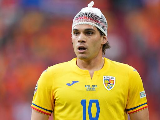 Fans compare Romania star to an onion as he is forced to wear hair net