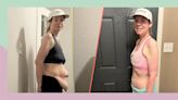 After losing 210 pounds, 1 mom has 4 pounds of excess skin removed. See the results.