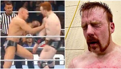 Sheamus' chest after fighting Gunther on Monday Night Raw proves how brutal WWE can be