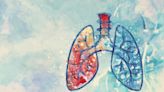 Study shows ivonescimab improves progression-free survival in EGFR+ lung cancer