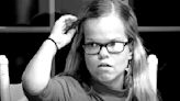 7 Little Johnstons: Fans Suspect Anna Suffers From This Condition!