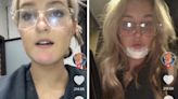 Woman gets chin infection from boyfriend’s beard stubble: ‘Worst week of my life’