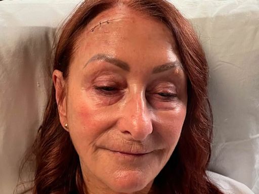 Lynne McGranger sparks concern as she shares photos of shock injuries