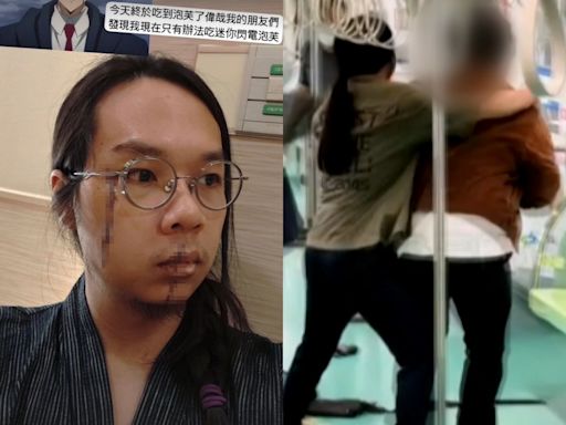 中捷英雄「長髮男」近況曝光！ 臉上留兩道長傷痕 還開玩笑道：終於吃到泡芙