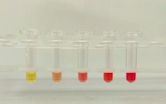 Hemolysis