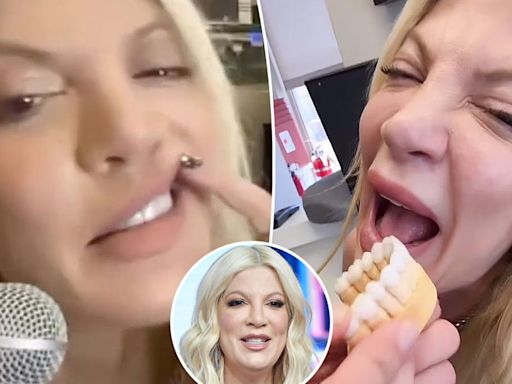 Tori Spelling has ‘never been happier’ since getting veneers to replace her ‘disgusting’ teeth: ‘I smile now’