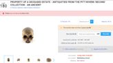 ‘Profiting from selling African body parts’: Auction house slammed over sale of Black human remains