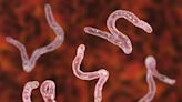 Could Infecting People With Hookworms Help Treat Ulcerative Colitis Someday?