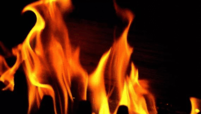 Student accidentally sets classmate on fire while attempting to injure himself in Eluru | Vijayawada News - Times of India