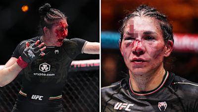 Fans gasp 'is that her brain' as fighter suffers 'worst cut in UFC history'