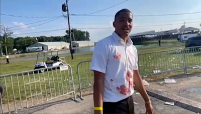 Trump rally speaker, covered in blood, describes putting hand on the head of attendee who was shot | CNN Politics