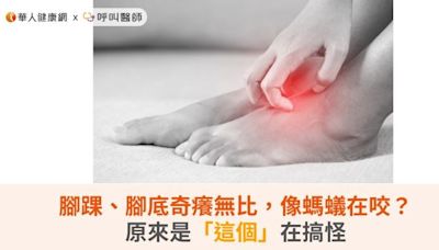 腳踝、腳底奇癢無比，像螞蟻在咬？原來是「這個」在搞怪 | 華人健康網 - 專業即時優質的健康新聞及資訊分享平台業即時優質的健康新聞及資訊分享平台