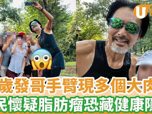 69歲周潤發手臂驚現多個大肉粒 網民懷疑脂肪瘤恐藏健康隱憂 | U Food 香港餐廳及飲食資訊優惠網站