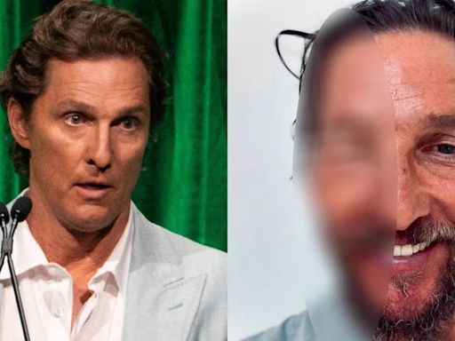 Matthew McConaughey fue picado por una abeja en la cara y su foto se hizo viral