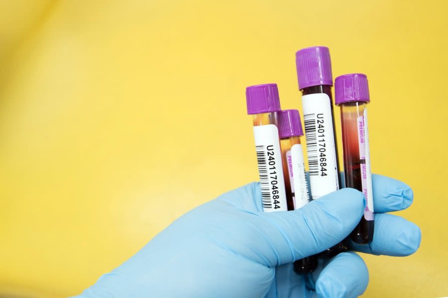Panel recommends blood test to detect colon cancer for FDA approval