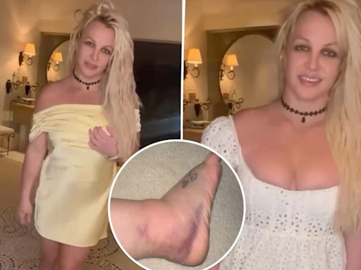 Britney Spears claims her massively swollen foot is ‘already better’ after it was ‘broken’ at Chateau Marmont