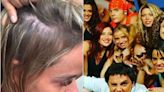 Ex chica Mekano reveló vía redes sociales su lucha contra la alopecia: “Mi intención es ayudar”