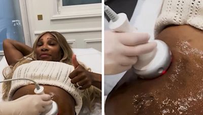 Serena Williams Gets Tummy-Tightening Procedure For Pre-Kids Confidence