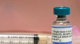 What you need to know about measles after Ohio outbreak sickens 19 children