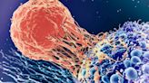 Cancer cases expected to grow by more than 20% in Europe by 2045 - WHO agency