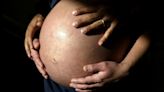 New blood tests aim to show who's at risk for preeclampsia, which can be fatal for pregnant people and babies