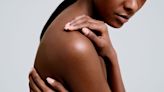 How I’m Managing My Eczema—Without Steroids