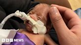 Bradford: MP condemns hospital leadership over baby deaths