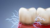 El hallazgo de canales iónicos abre la puerta al tratamiento del dolor dental