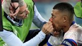 Mbappé’s facial injury places doubt on his continued involvement in Euro 2024 - WTOP News