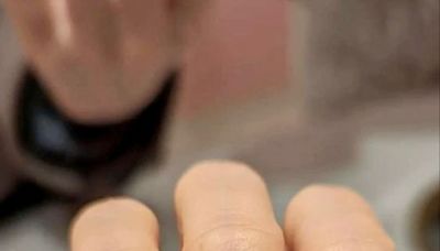 指甲周圍的疼痛~很可能是因為「甲溝炎」，不理它能自己好嗎？