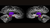 Super-detailed map of brain cells that keep us awake could improve our understanding of consciousness