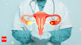 Ovarian Cancer: Preventative measures to keep the ‘silent killer’ at bay - Times of India