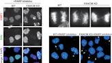 Researchers shed light on cancer drug resistance, potential to expand use of PARP inhibitors across cancer types