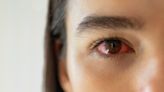 "Cela peut provoquer une infection grave" : ces cinq choses à ne jamais faire sur vos yeux, selon une optométriste