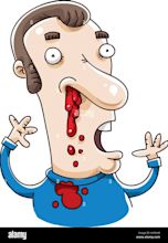 A cartoon man upset because he has a bloody nose Stock Vector Image ...