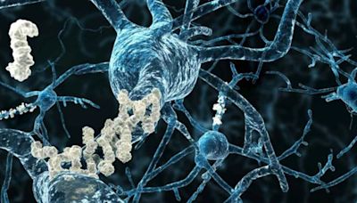 Aprueban una nueva droga para las etapas tempranas del Alzheimer: podría demorar el deterioro cognitivo