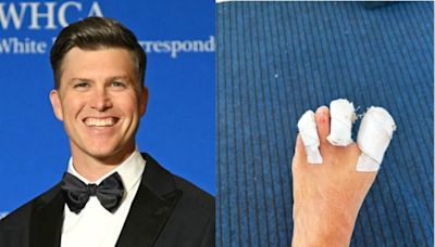 Colin Jost shares photo of bloodied foot injury while covering Olympic surfing in Tahiti