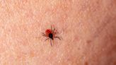 Ticks and the diseases they carry