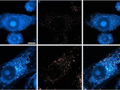 Challenging Old Theories: Innovative Microscopy Exposes New Alzheimer’s Treatment Pathways