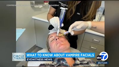 'Vampire facials' growing in popularity, but how do you know if they're safe? Doctors weigh in