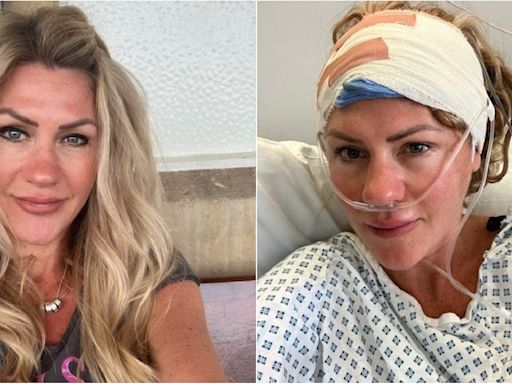 Woman, 43, reveals first symptom of her 'golf ball-sized' brain tumour